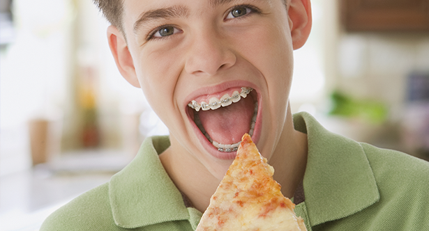 Foods To Avoid With Braces Australia Keenan Sheffield 