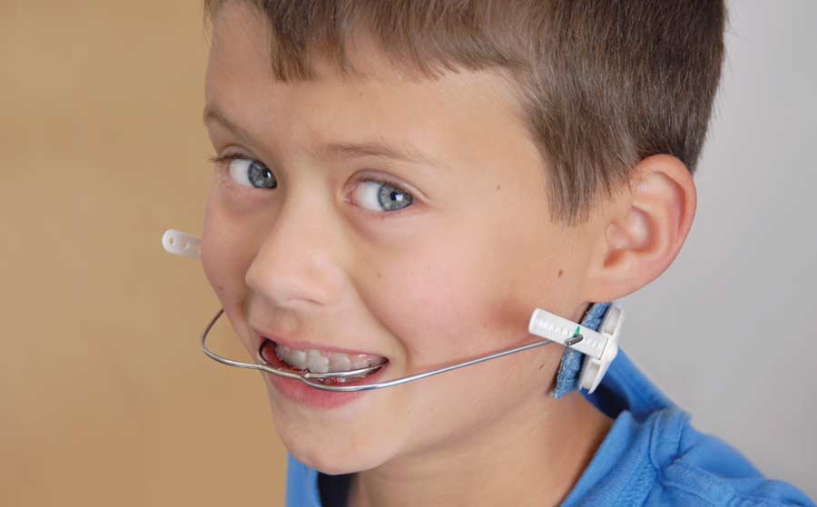 The Benefits of Phase I Orthodontic Treatment Orthosmile Orthodontics